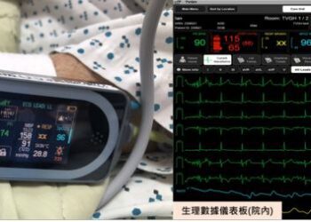 中榮智慧救護　首創同時監測連續性血壓及心電圖即時傳輸