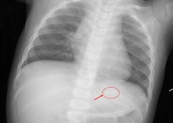 危機暗藏 國際加熱菸傷童案例頻傳 台灣審查機制亟待完善