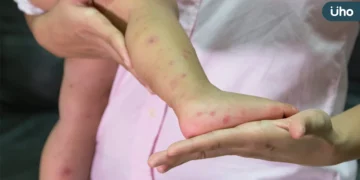 OPEN現身萬芳醫院陪童過節 洗手操防腸病毒寓教於樂