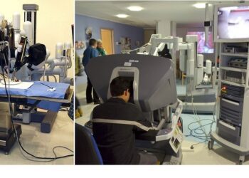 美完成第一例機器人肝臟移植微創手術