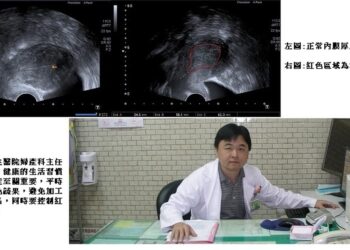 停經後不正常出血  可能是這個病