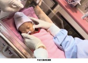 早產兒尋根反射 復健重點