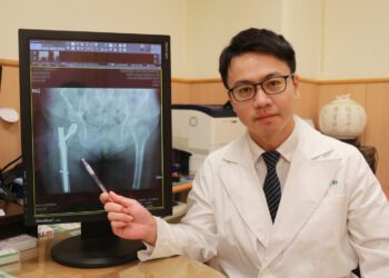 微創骨髓內釘加骨水泥治髖部骨折 健保有差額給付