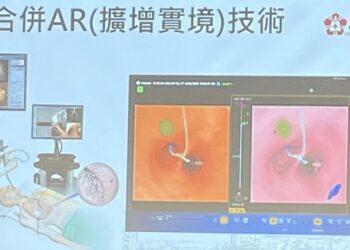 臺南成醫虛擬導航精準診斷肺癌氣管切片