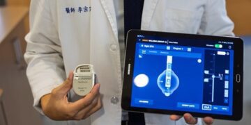 刺激術治巴金森病納健保台南成醫搭配立體定位提升療效