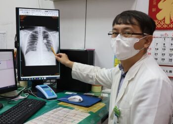 外籍移工抽菸又在粉塵場所工作　來台3年健檢揪出罹患肺癌