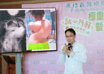 國際人道醫療　嘉基轉變11歲緬甸女童160度脊椎側彎命運